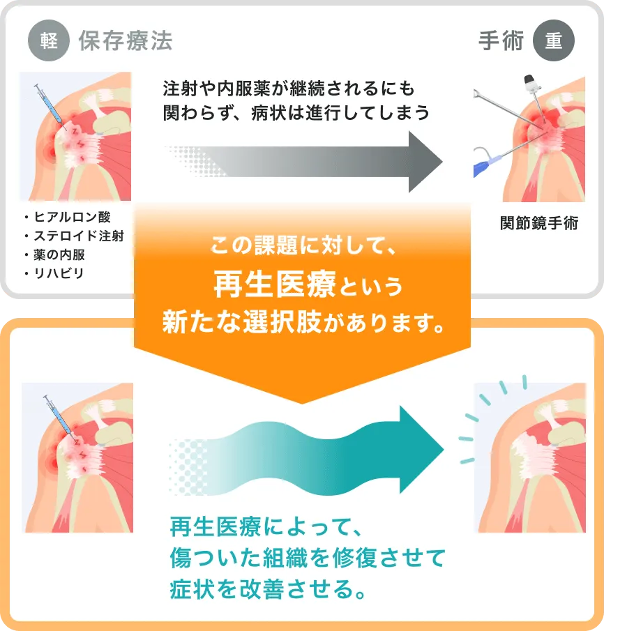 スポーツ外傷｜治療内容｜シンセルクリニック - ひざ・肩