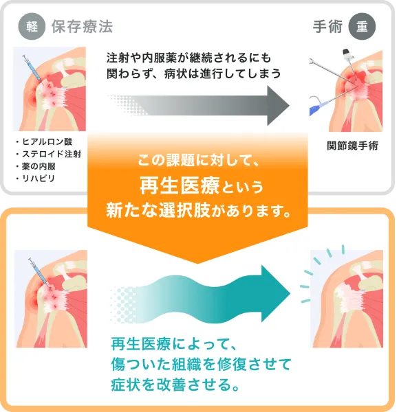 従来の保存療法と再生医療との症状の進行比較図