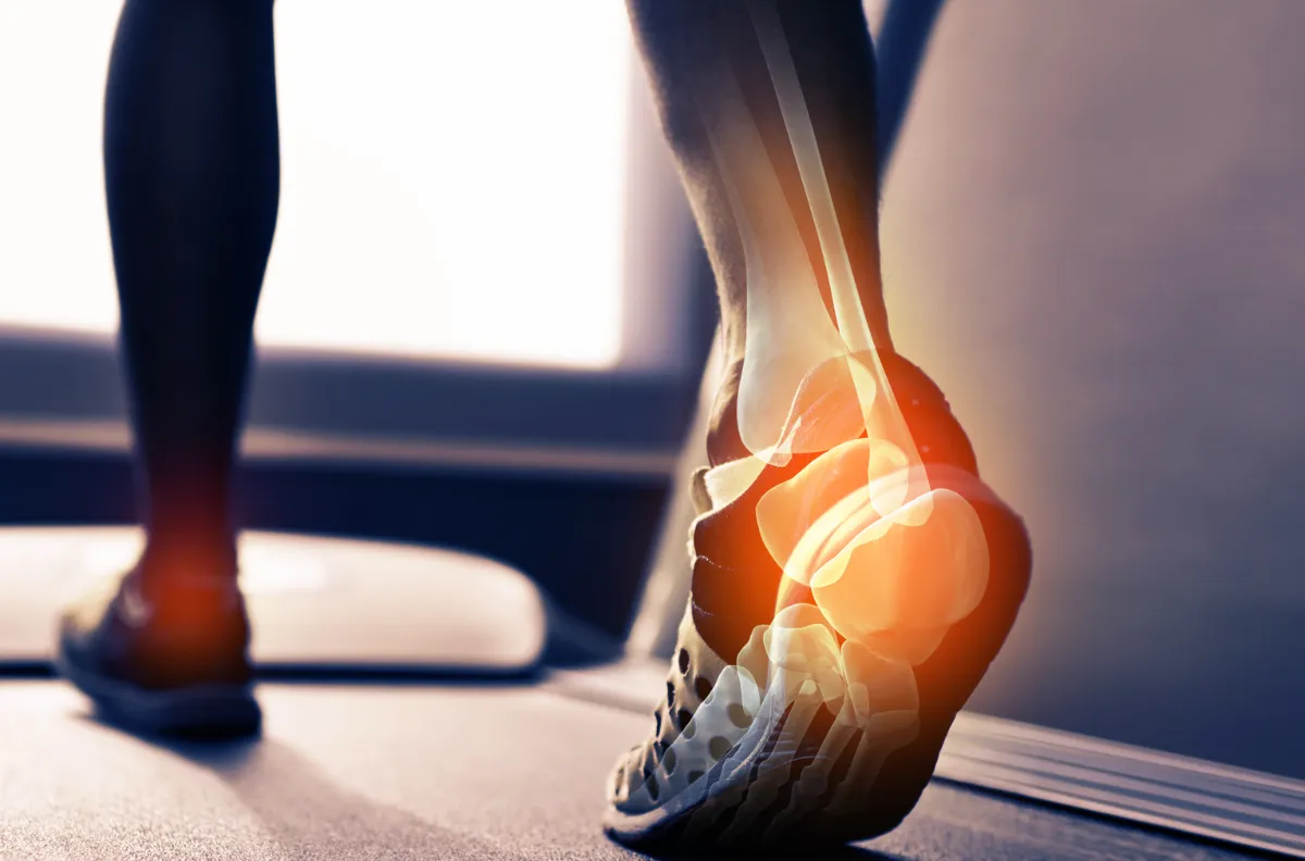GAIT ANALYSIS 歩行分析 正常歩行と異常歩行 歩行分析 : 正常歩行と異常歩行 - メルカリ