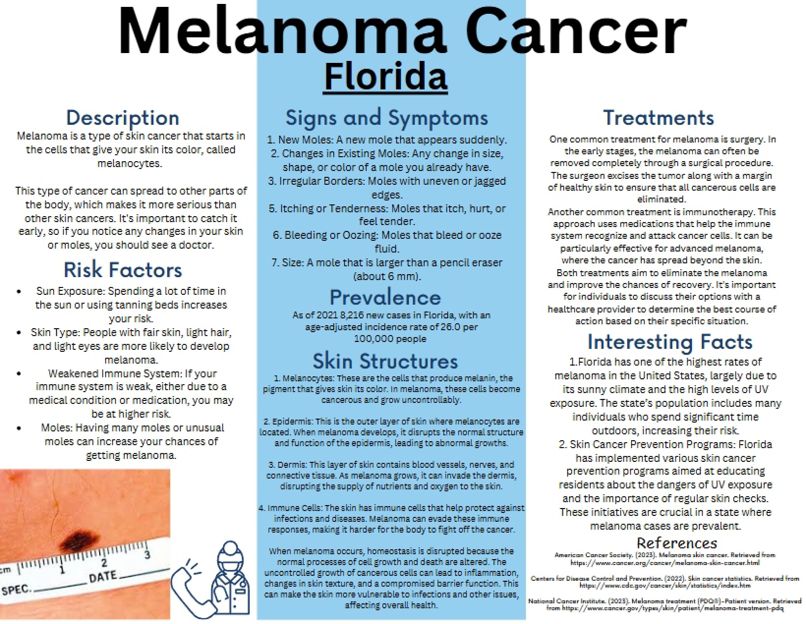 Melanoma Cancer Analysis