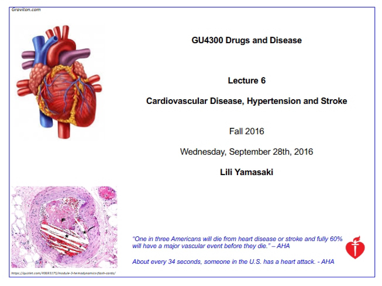 Stroke, Hypertension, and Cardiovascular Disease