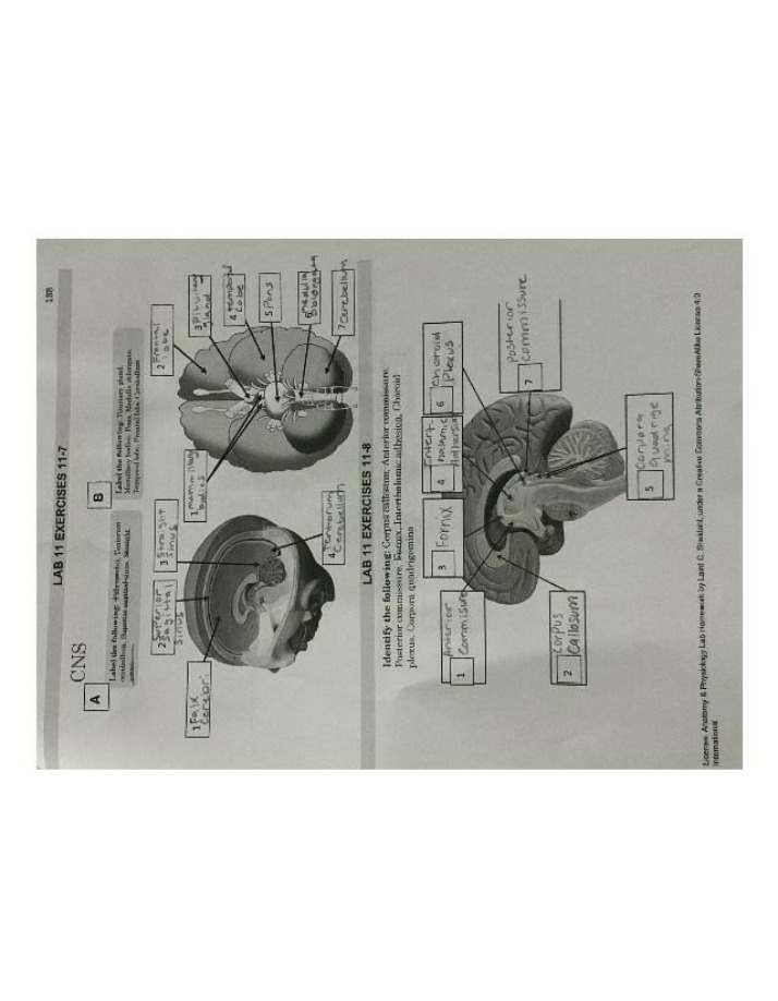 Anatomy Lab - Labeling and Identifying CNS Structures