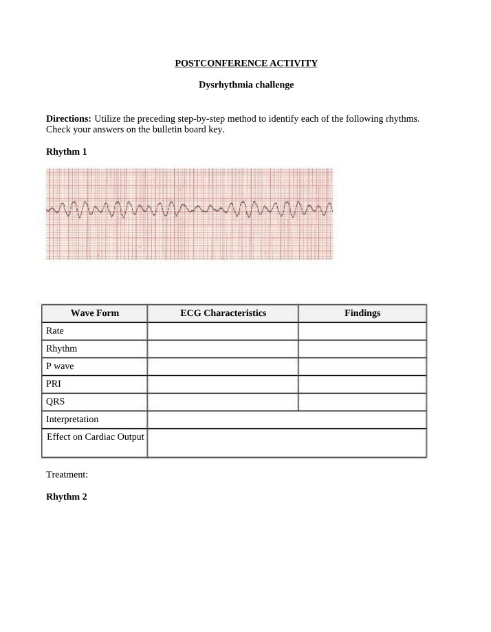 Challenge for Dysrhythmia Identification