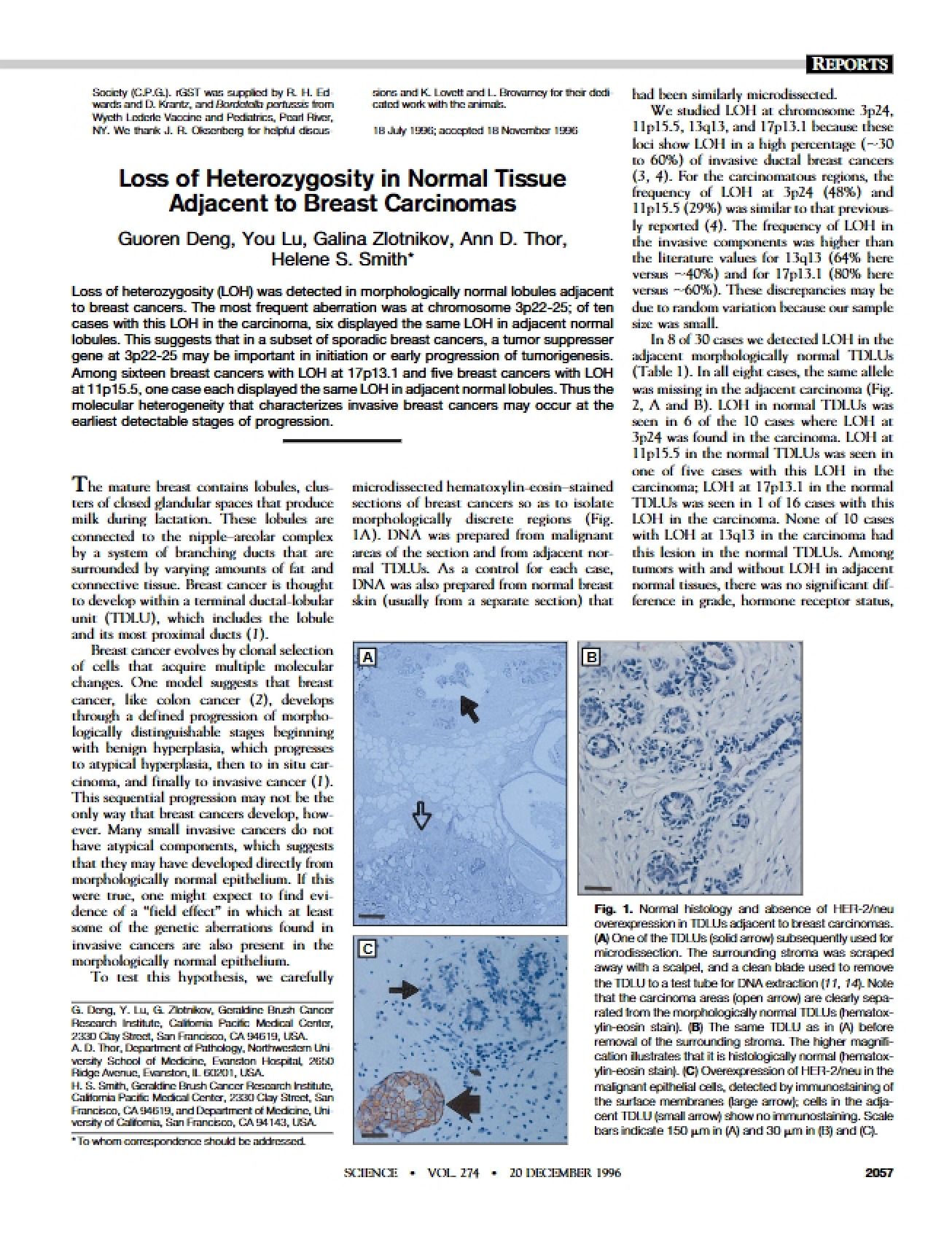 Carcinomas of the Breast