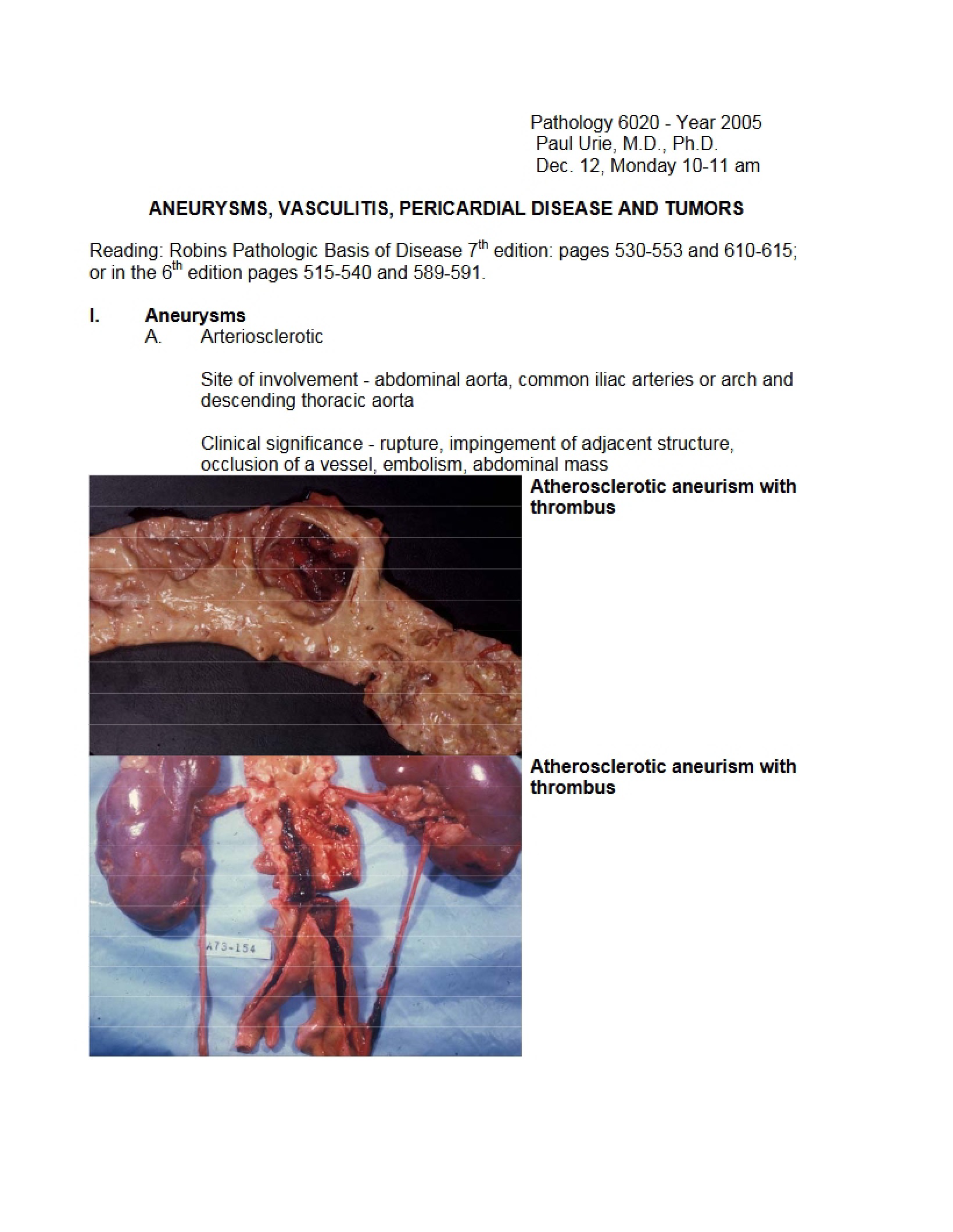 Tumors, Pericardial Disease, Vasculitis, and Aneurysms