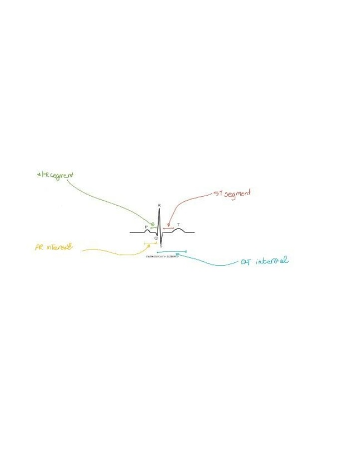 ECG Segments and Intervals