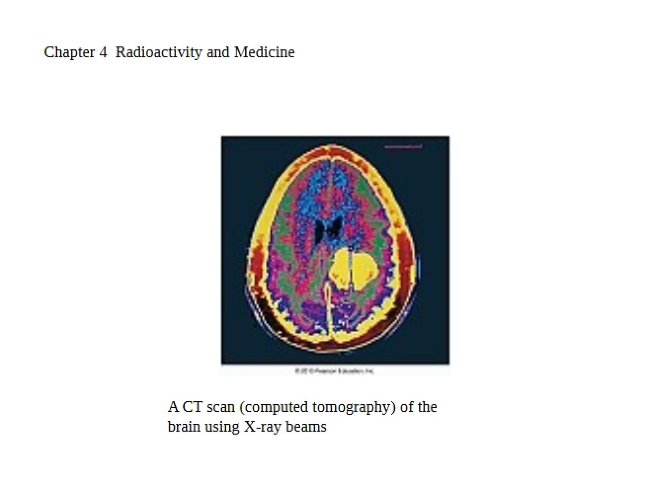 Medicine and Radioactivity