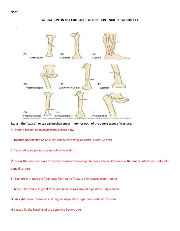 Worksheet for Musculoskeletal Fractures - Causes and Types