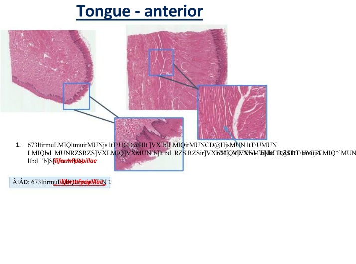 Tongue Structures - Filiform and Circumvallate Papillae Anatomy