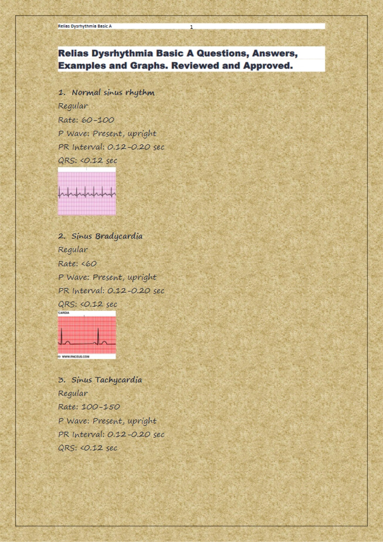 Dysrhythmia (Relias)