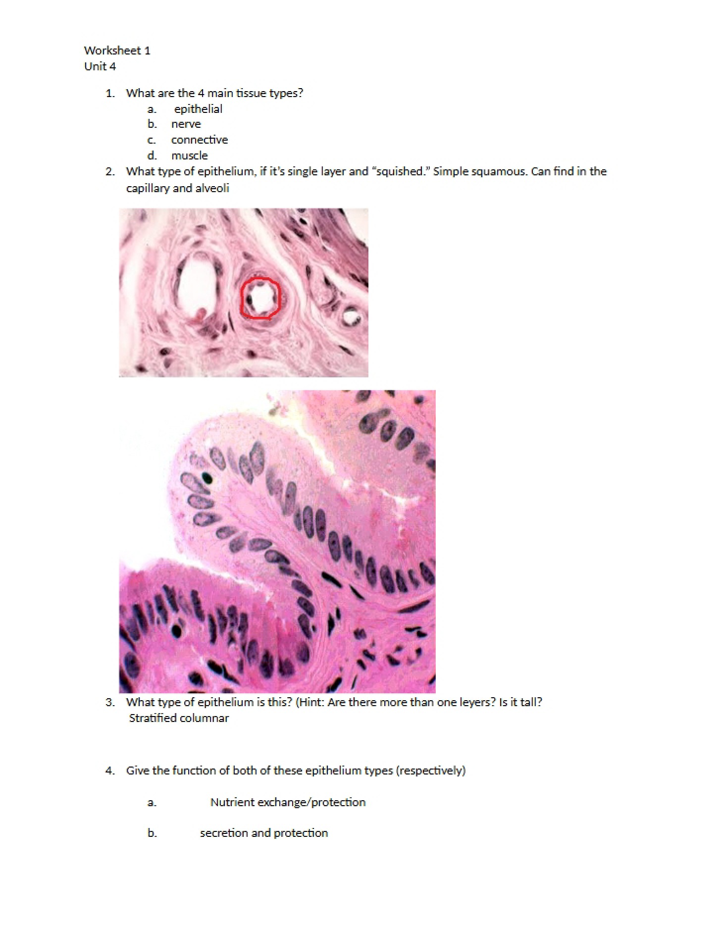 Answers Unit 4 Worksheet 1