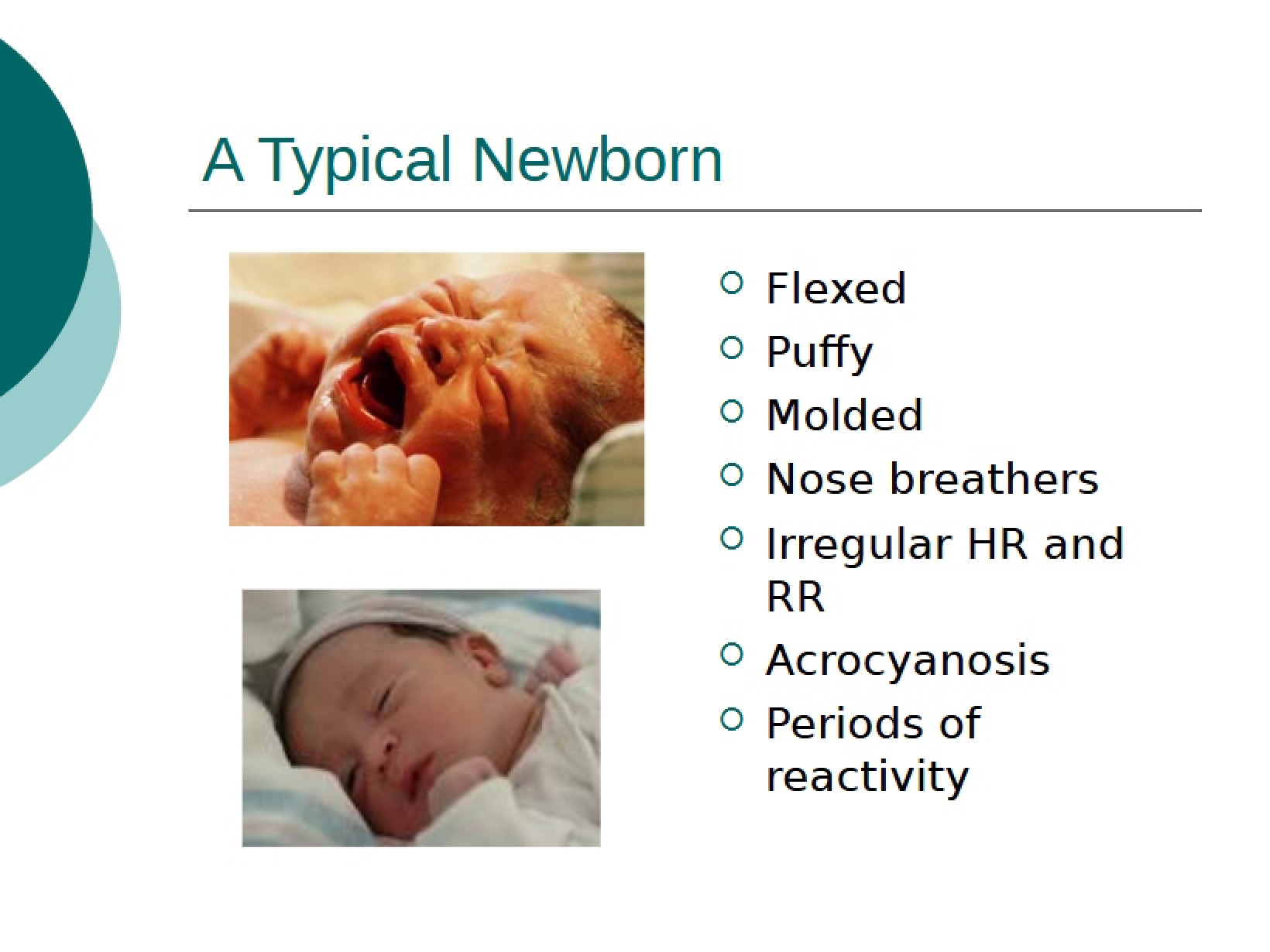 Newborn Characteristics (Typical)