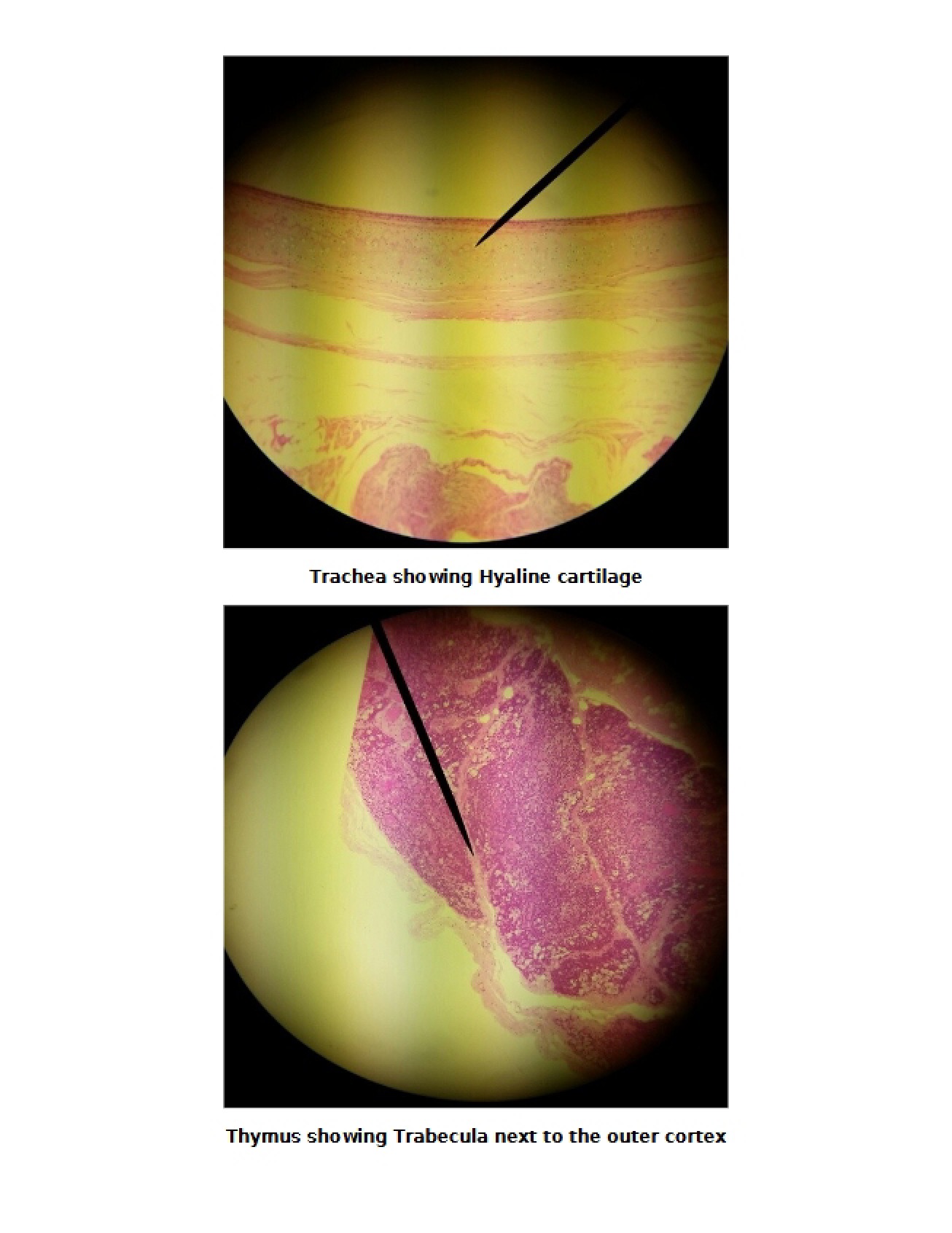 Hyaline Cartilage as seen in the Trachea