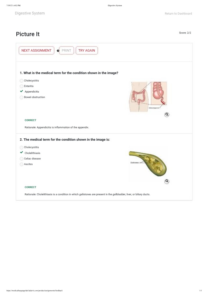 Digestive System Conditions Quiz - Appendicitis and Cholelithiasis