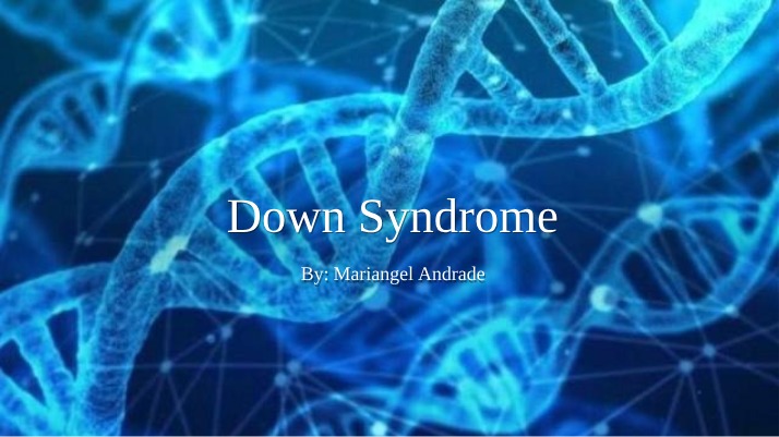 Overview of Down Syndrome