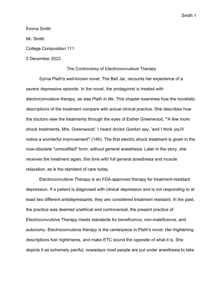 Comparative Analysis - Electroconvulsive Therapy Controversy