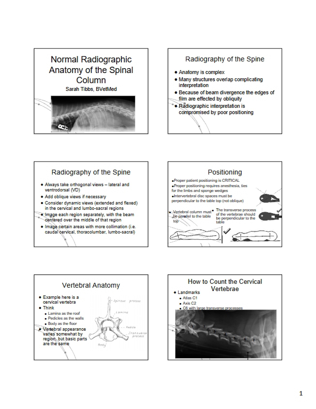 Spinal Column Anatomy Normal Radiographic Views
