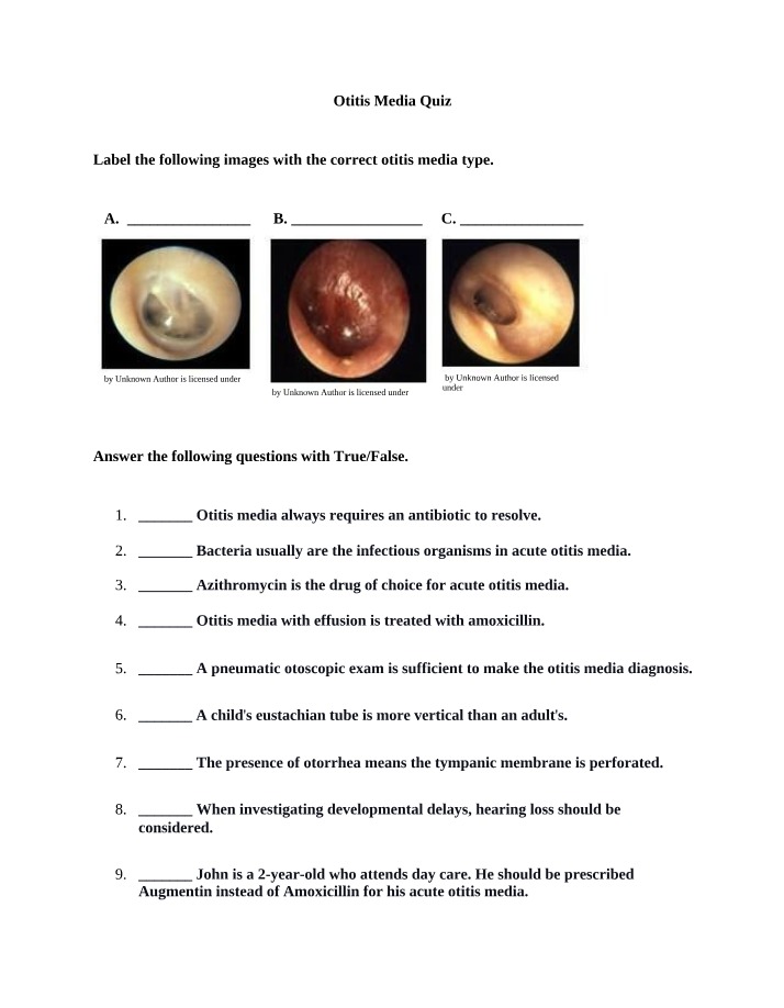 Quiz on Otitis Media