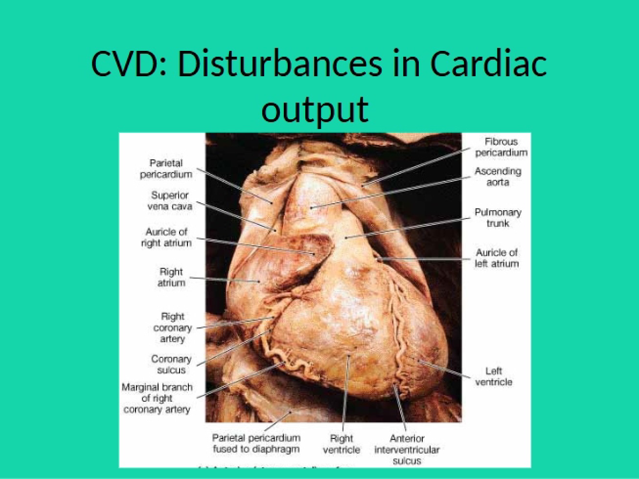 Cardiac Output Disturbances (CVD)
