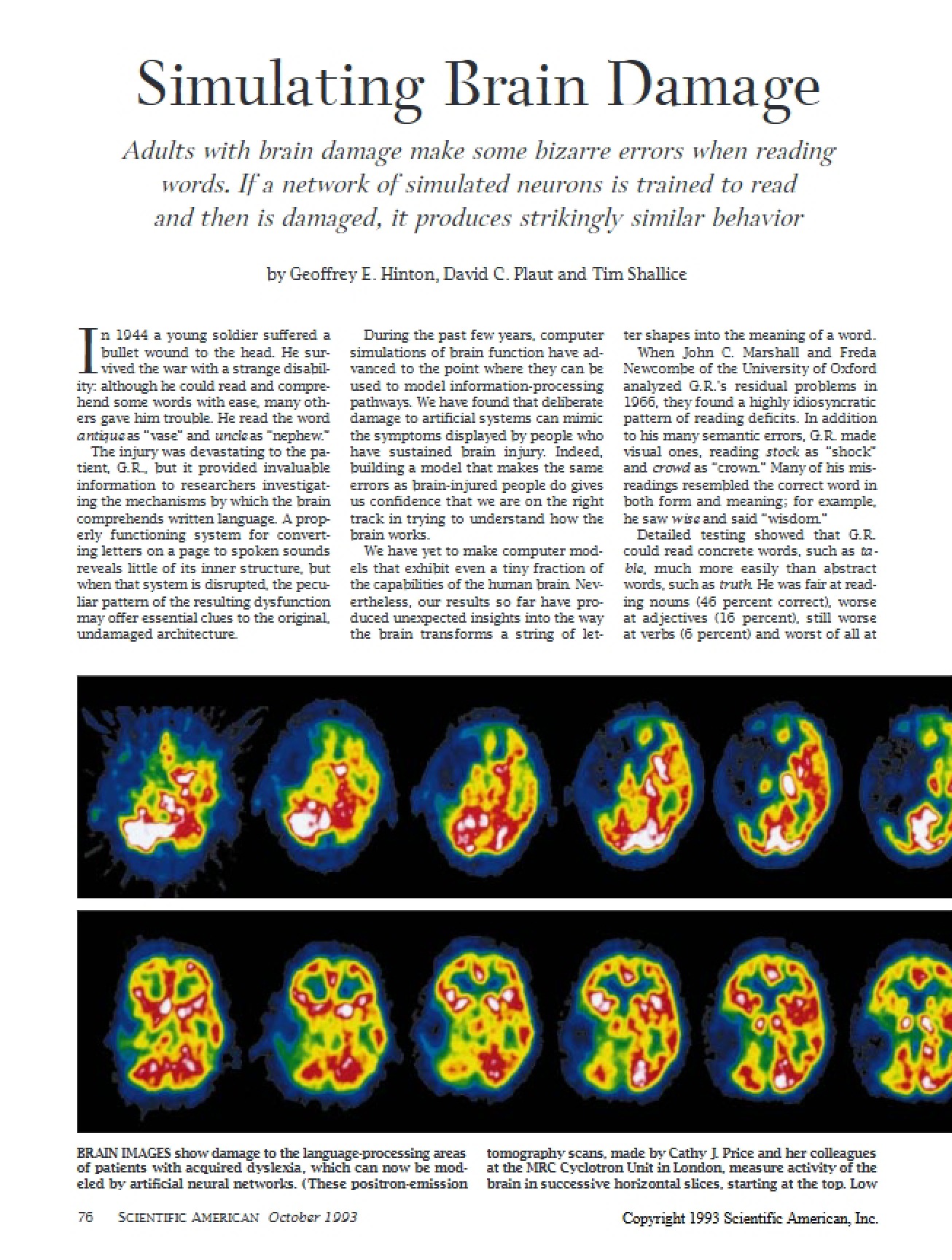 Brain Damage Simulation
