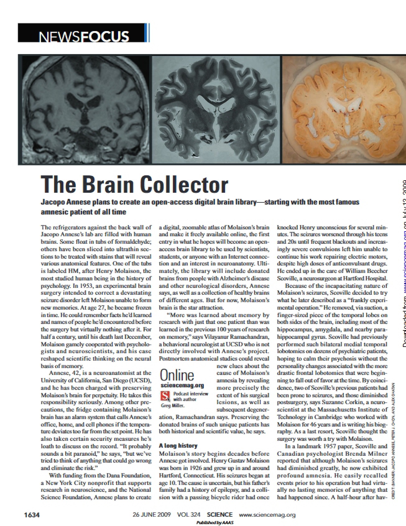 Brain Anatomy
