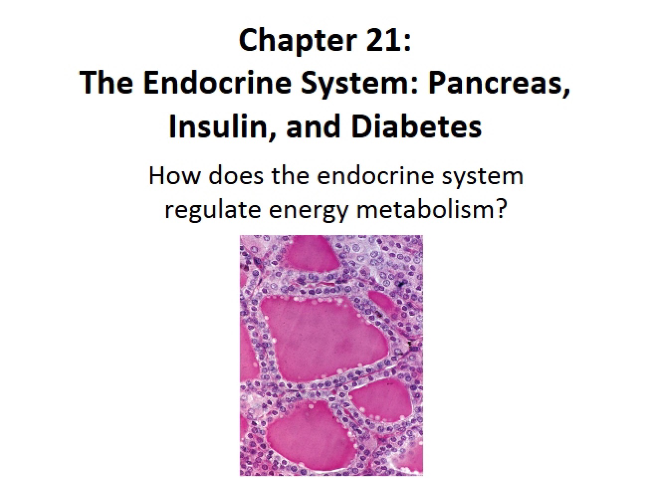 Topic 8 Handout Diabetes, Insulin, and the Pancreas
