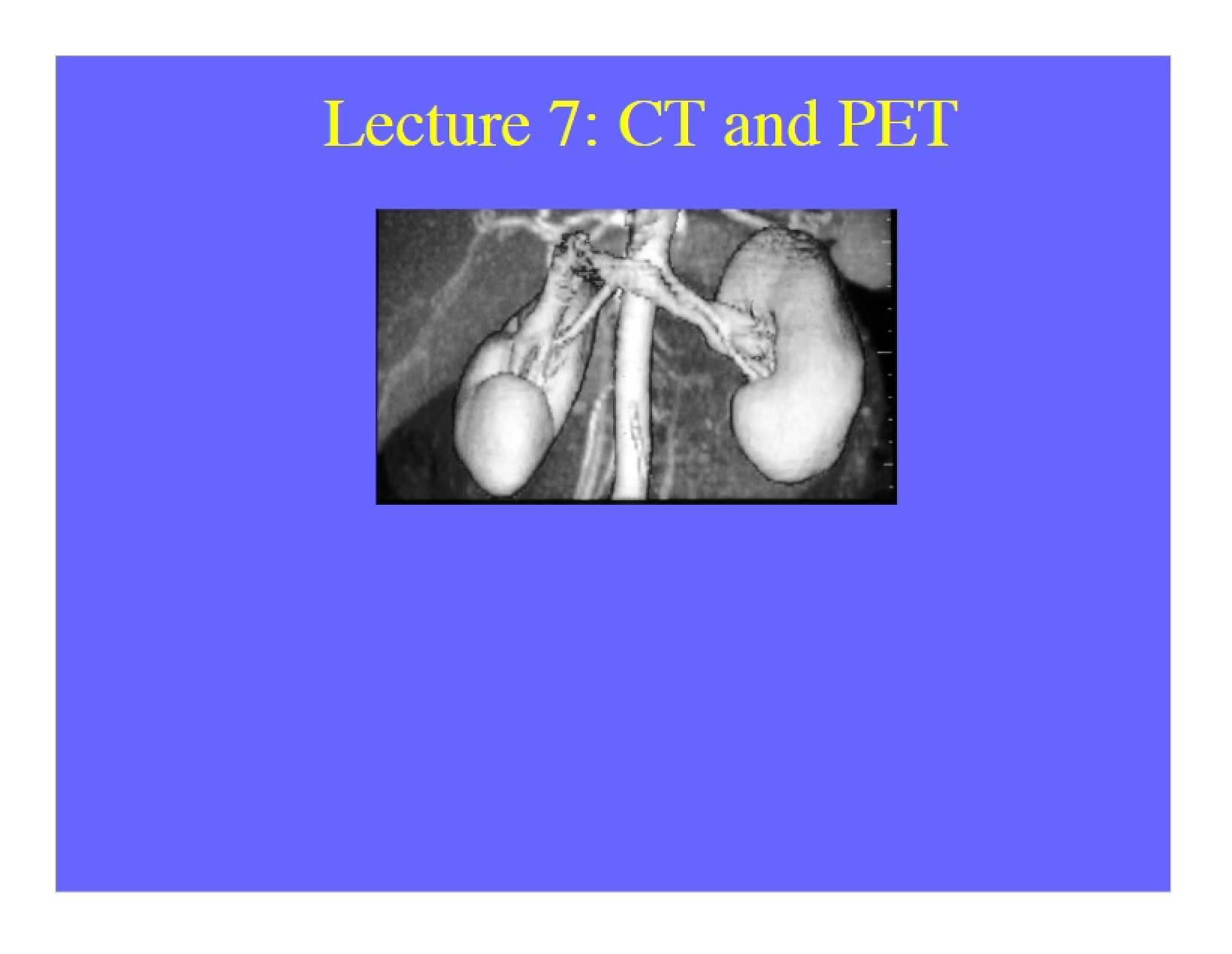 PET and CT Scanning Lecture 7