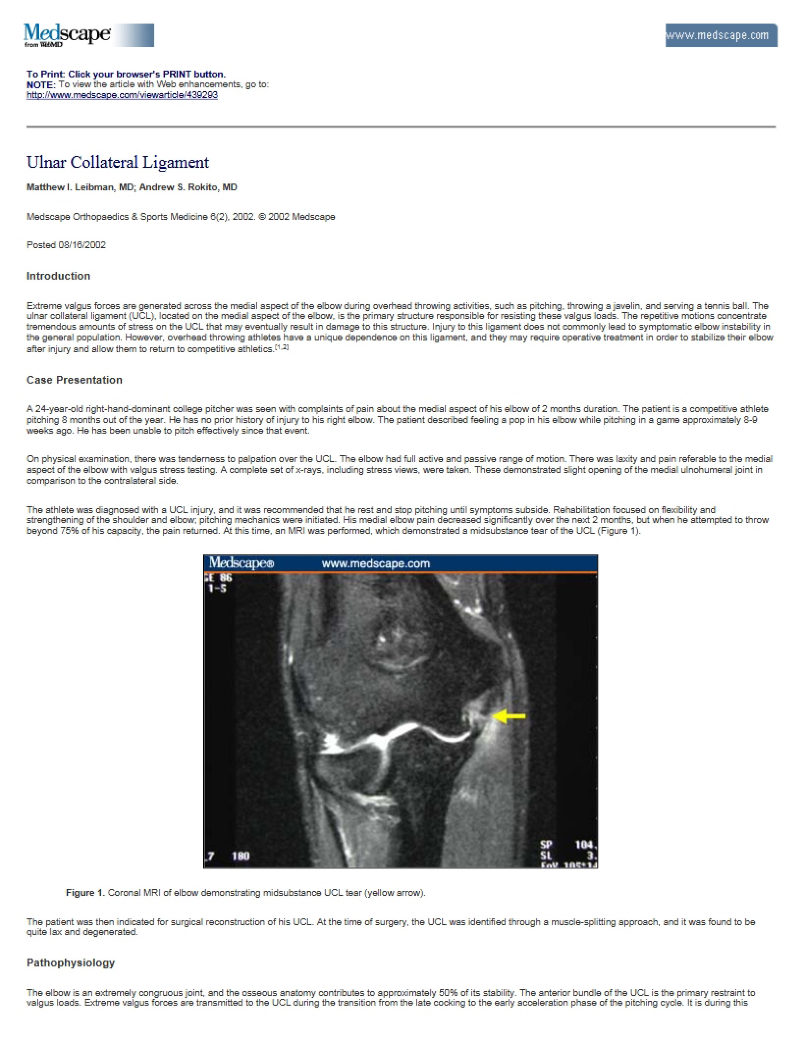 Ligament Ulnar Collateral