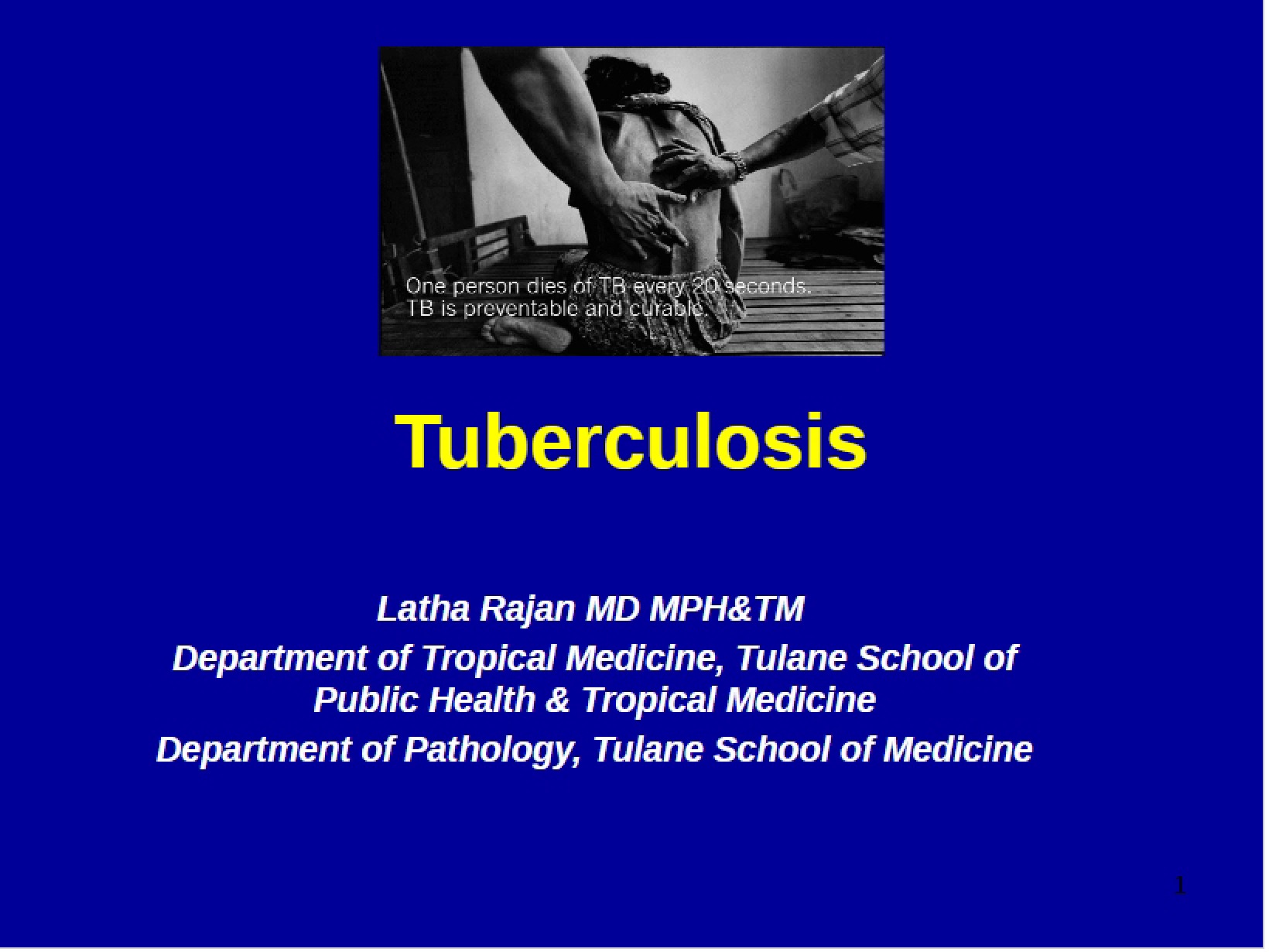 Lecture 16 Tuberculosis
