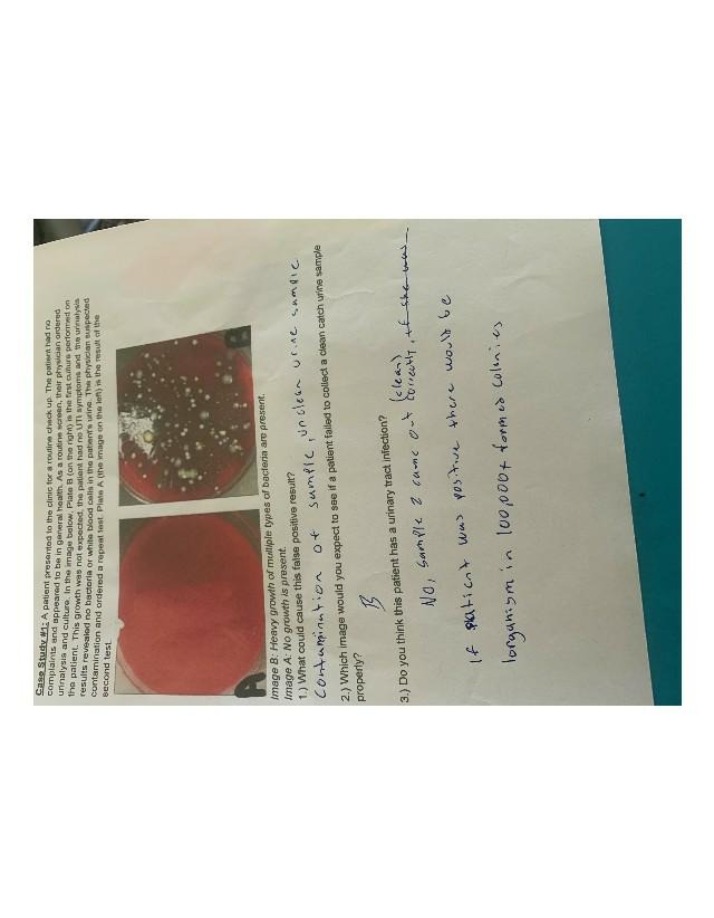 Unexpected Bacterial Growth in Urinalysis