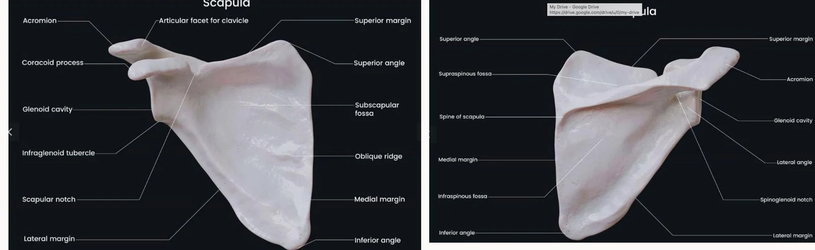 Anatomical illustration of the scapula, also known as the shoulder blade, with various parts labeled, including the acromion, coracoid process, glenoid cavity, and spine.