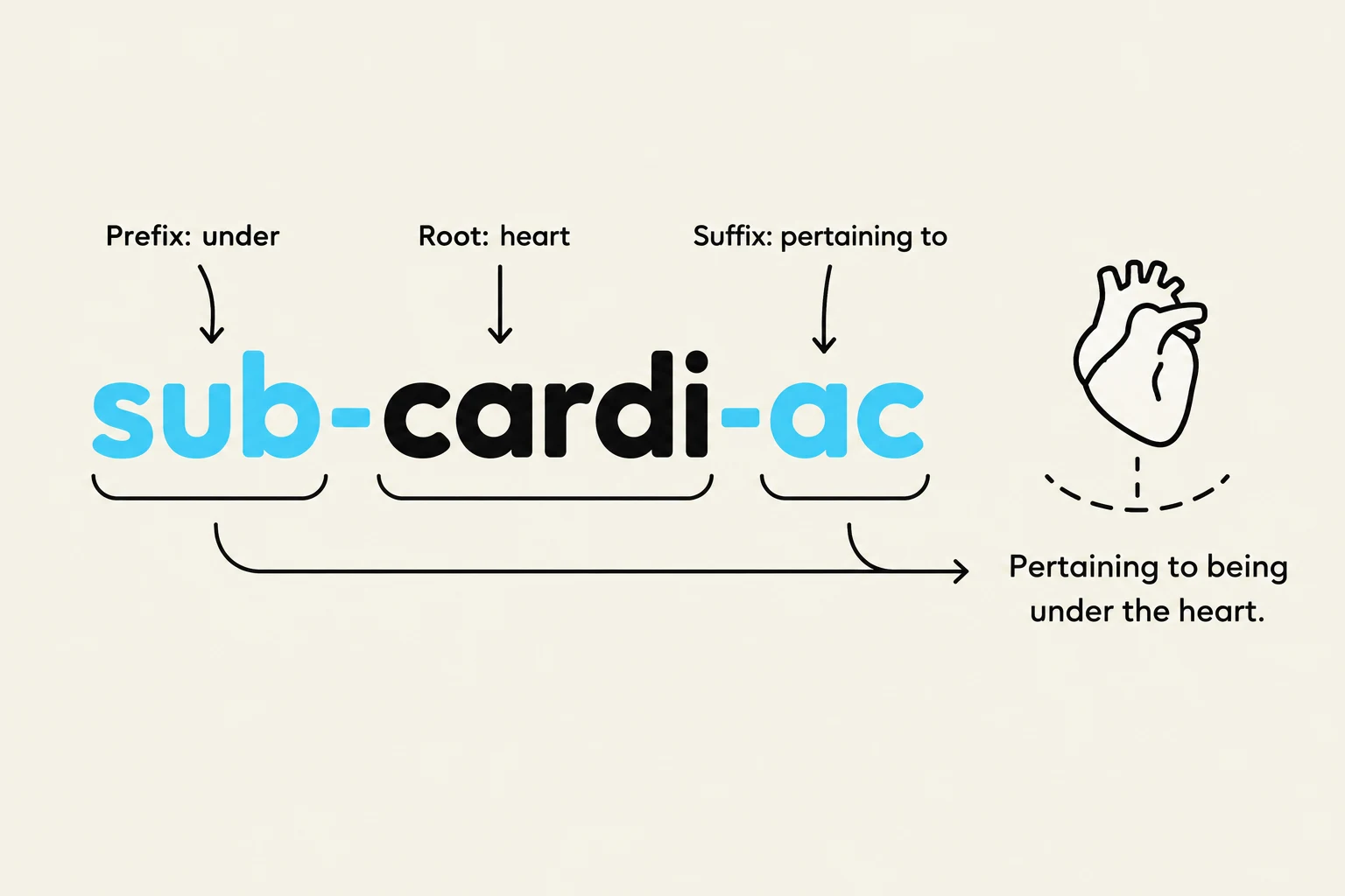 The word "subcardiac" is broken down into its prefix "sub" (under), root "cardi" (heart), and suffix "ac" (pertaining to), illustrating its meaning as pertaining to being under the heart.