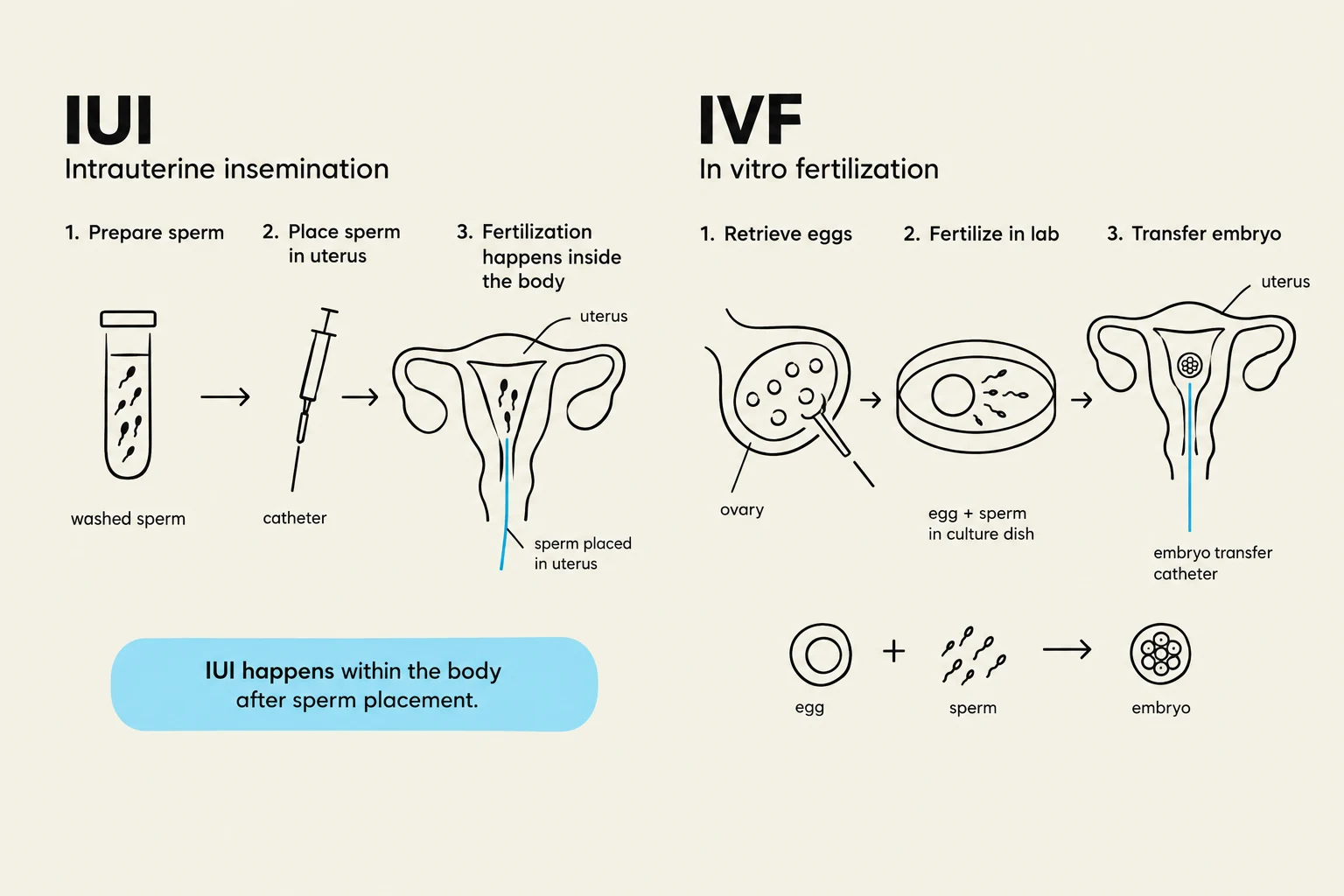 Diagrams illustrating the processes of Intrauterine Insemination (IUI) and In Vitro Fertilization (IVF).