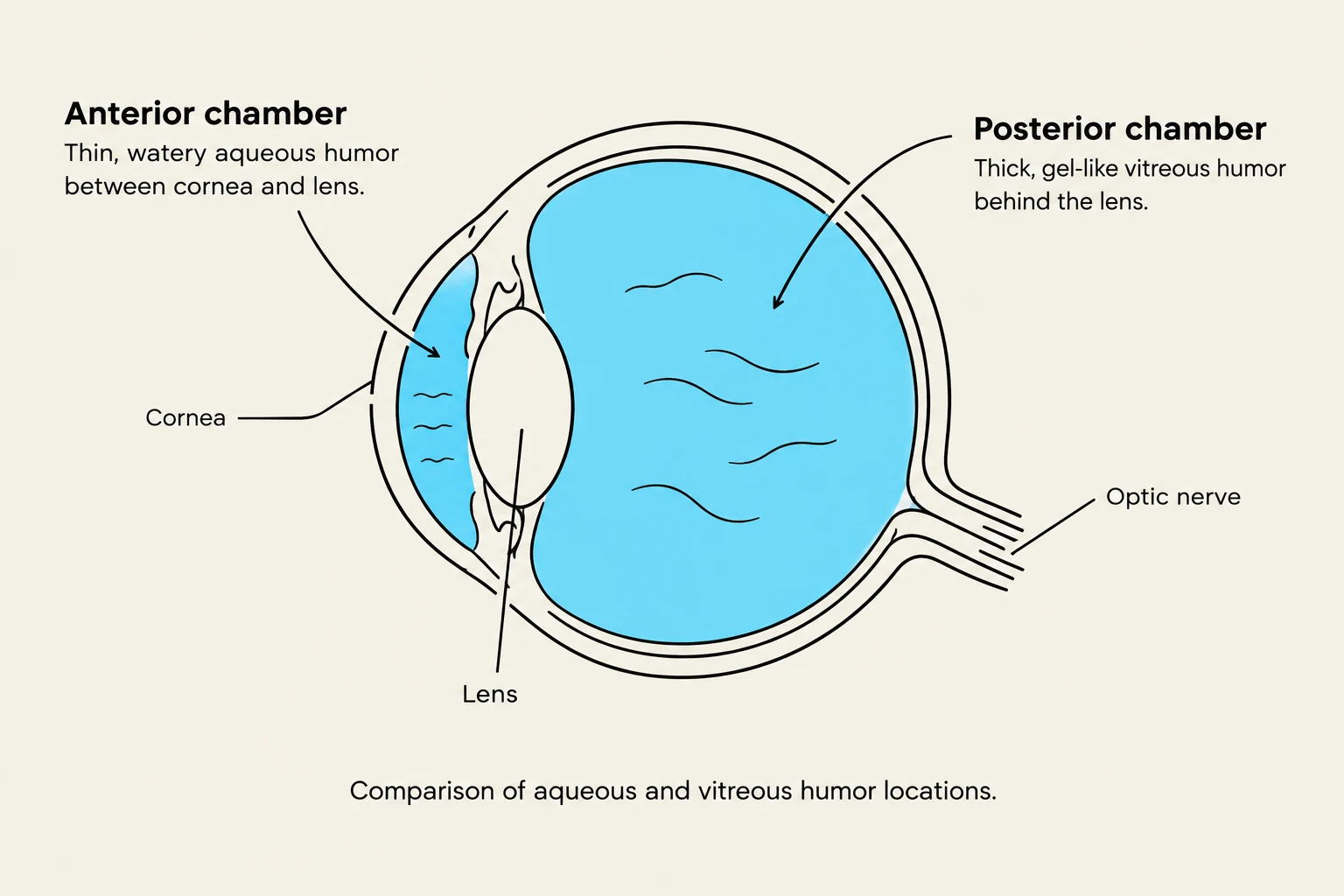 Comparison of aqueous and vitreous humor locations within the eye.