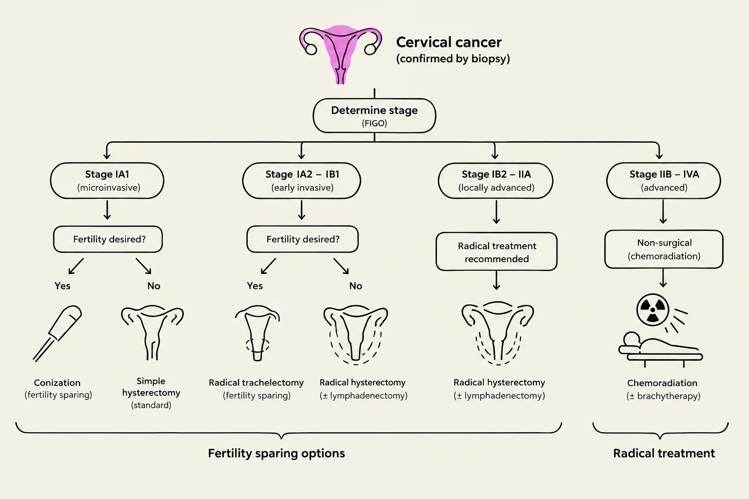 This flowchart illustrates the staging and treatment options for cervical cancer, including fertility-sparing procedures and radical treatments.