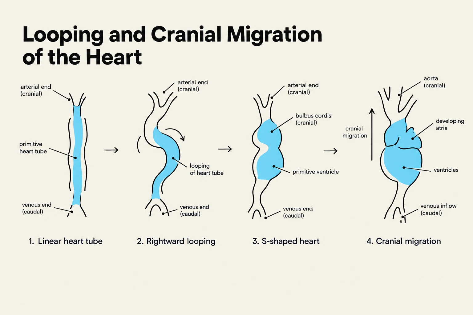 Diagram illustrating the stages of heart development, including linear heart tube formation, rightward looping, S-shaped heart development, and cranial migration.