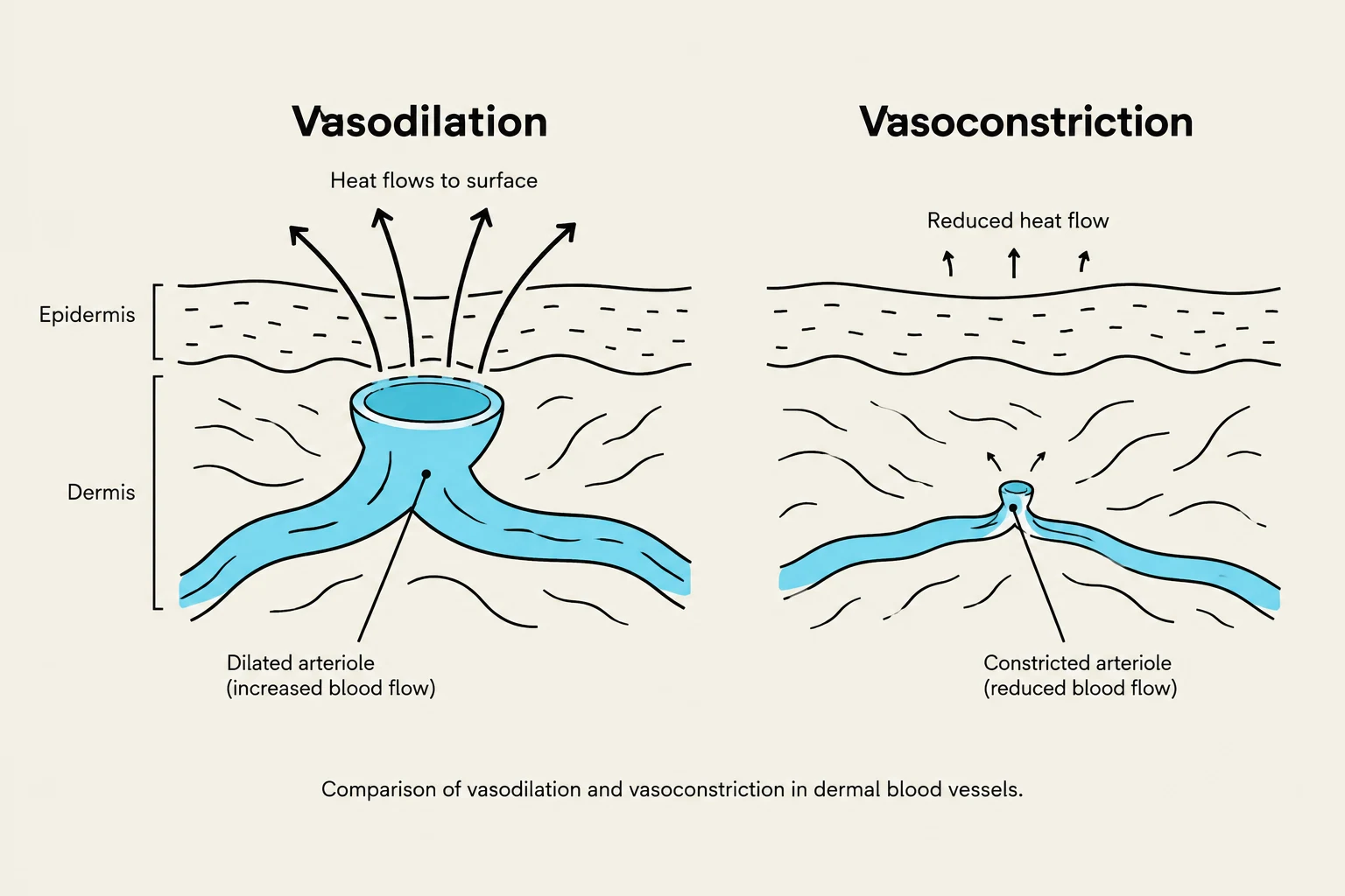 Comparison of vasodilation and vasoconstriction in dermal blood vessels.