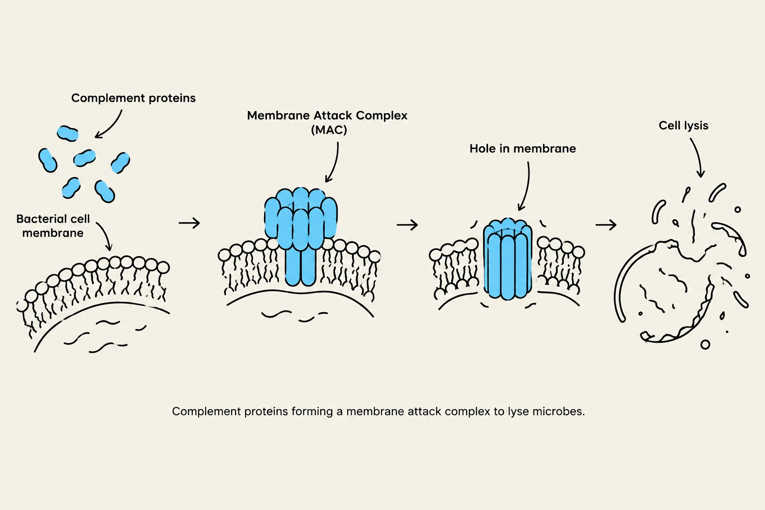 Complement proteins forming a membrane attack complex to lyse microbes.