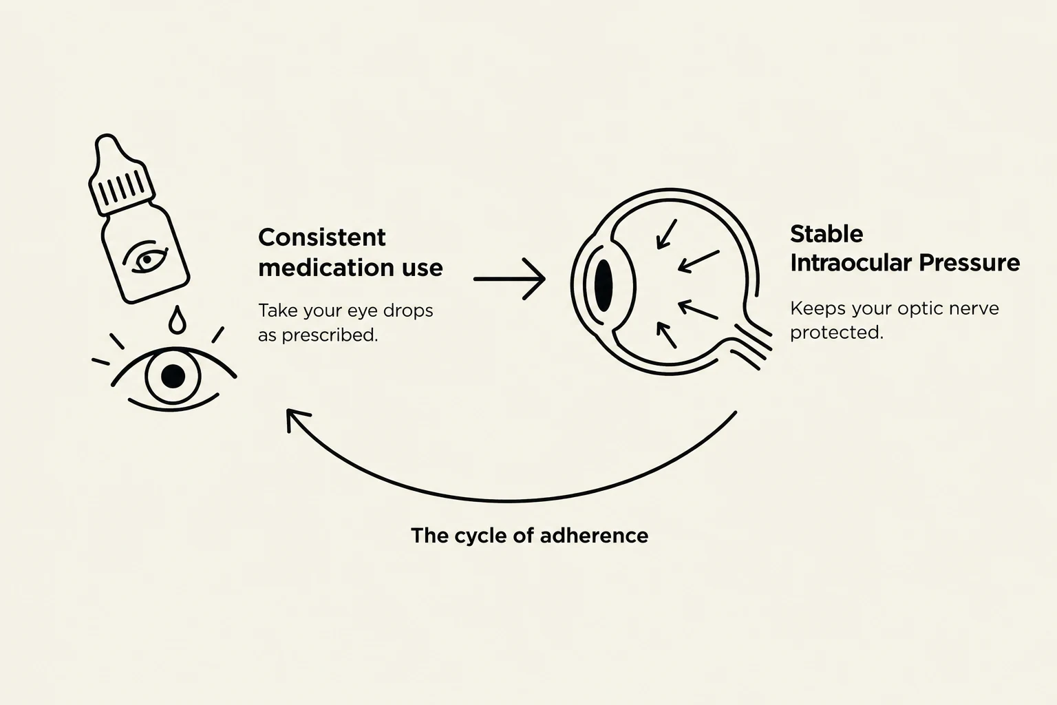 This diagram illustrates the cycle of adherence for consistent medication use, showing how taking eye drops as prescribed leads to stable intraocular pressure, which protects the optic nerve.