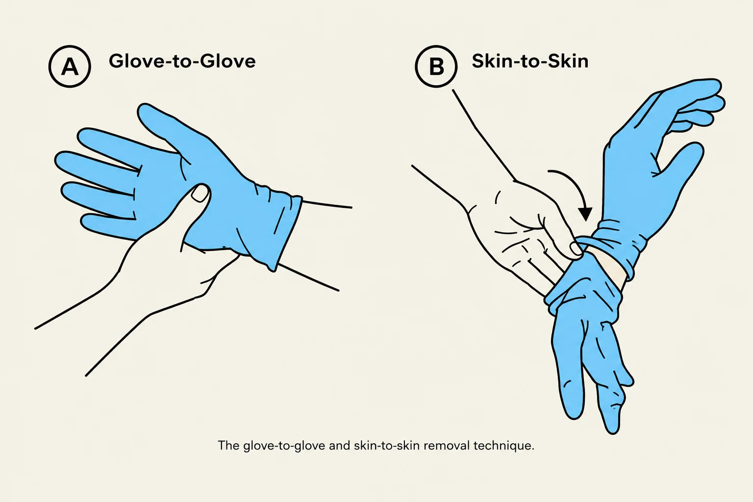 The glove-to-glove and skin-to-skin removal technique.