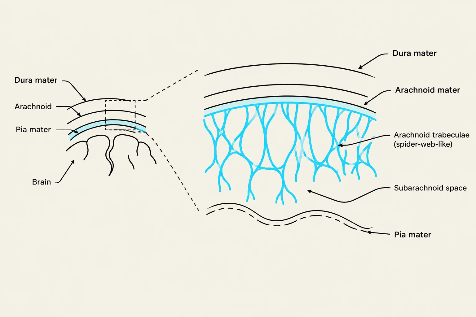 Diagram illustrating the layers of the meninges surrounding the brain: dura mater, arachnoid mater, and pia mater, with a magnified view of the arachnoid trabeculae and subarachnoid space.