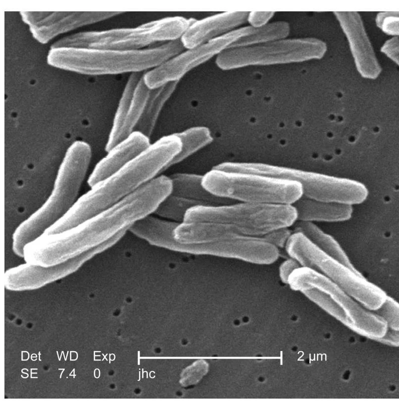 Scanning electron micrograph of Mycobacterium tuberculosis bacteria.