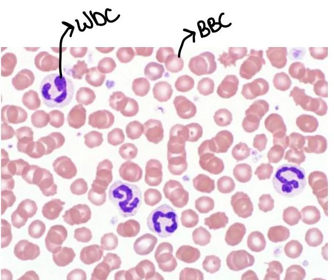 Microscopic view of human blood cells, showing red blood cells (RBCs) and white blood cells (WBCs).