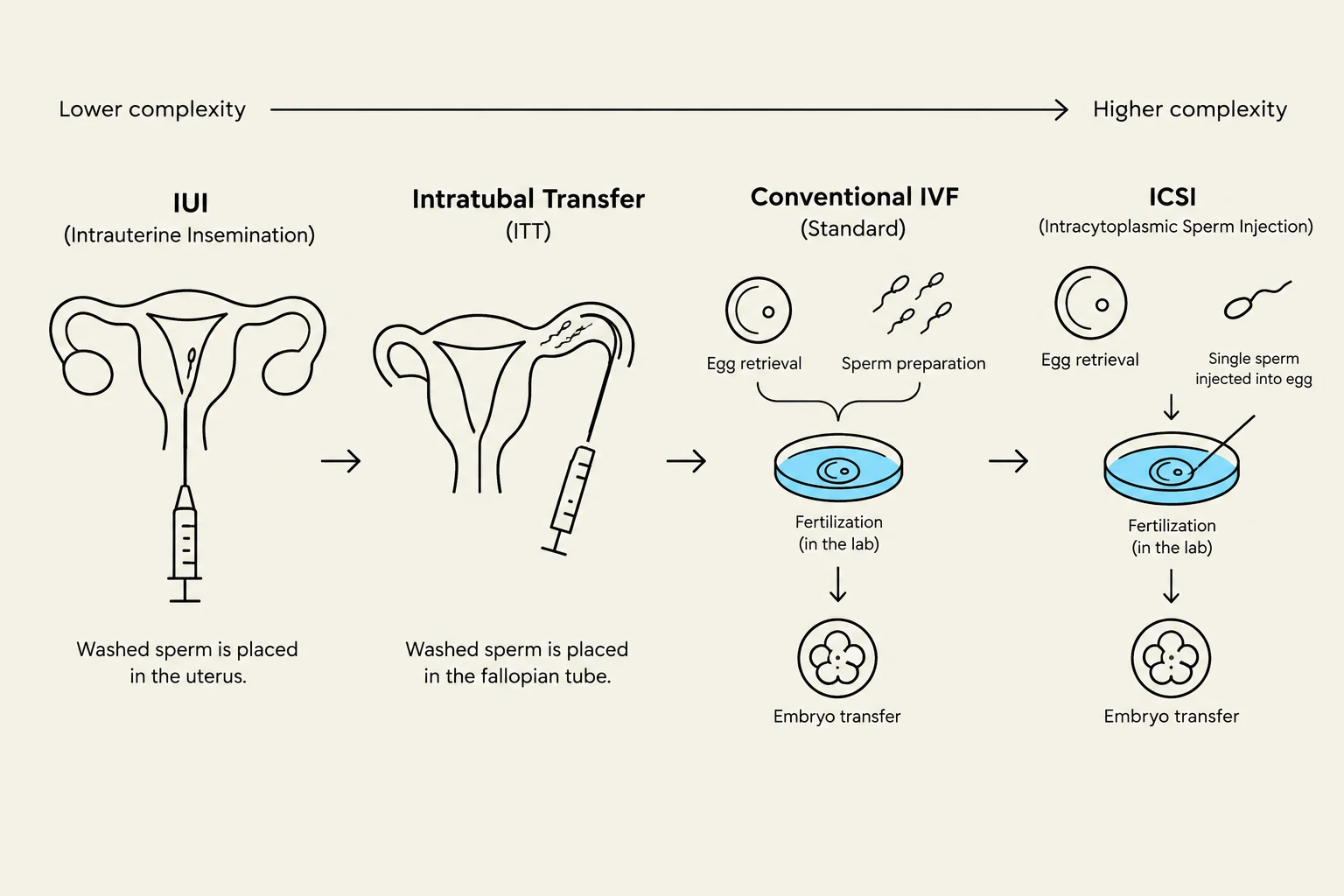 This diagram illustrates different assisted reproductive technologies, including IUI, Intratubal Transfer (ITT), Conventional IVF, and ICSI, ordered by increasing complexity.