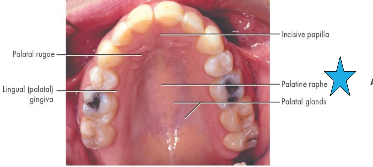 An anatomical illustration of the roof of the human mouth, labeling the palatal rugae, incisive papilla, palatine raphe, palatal glands, and lingual gingiva.