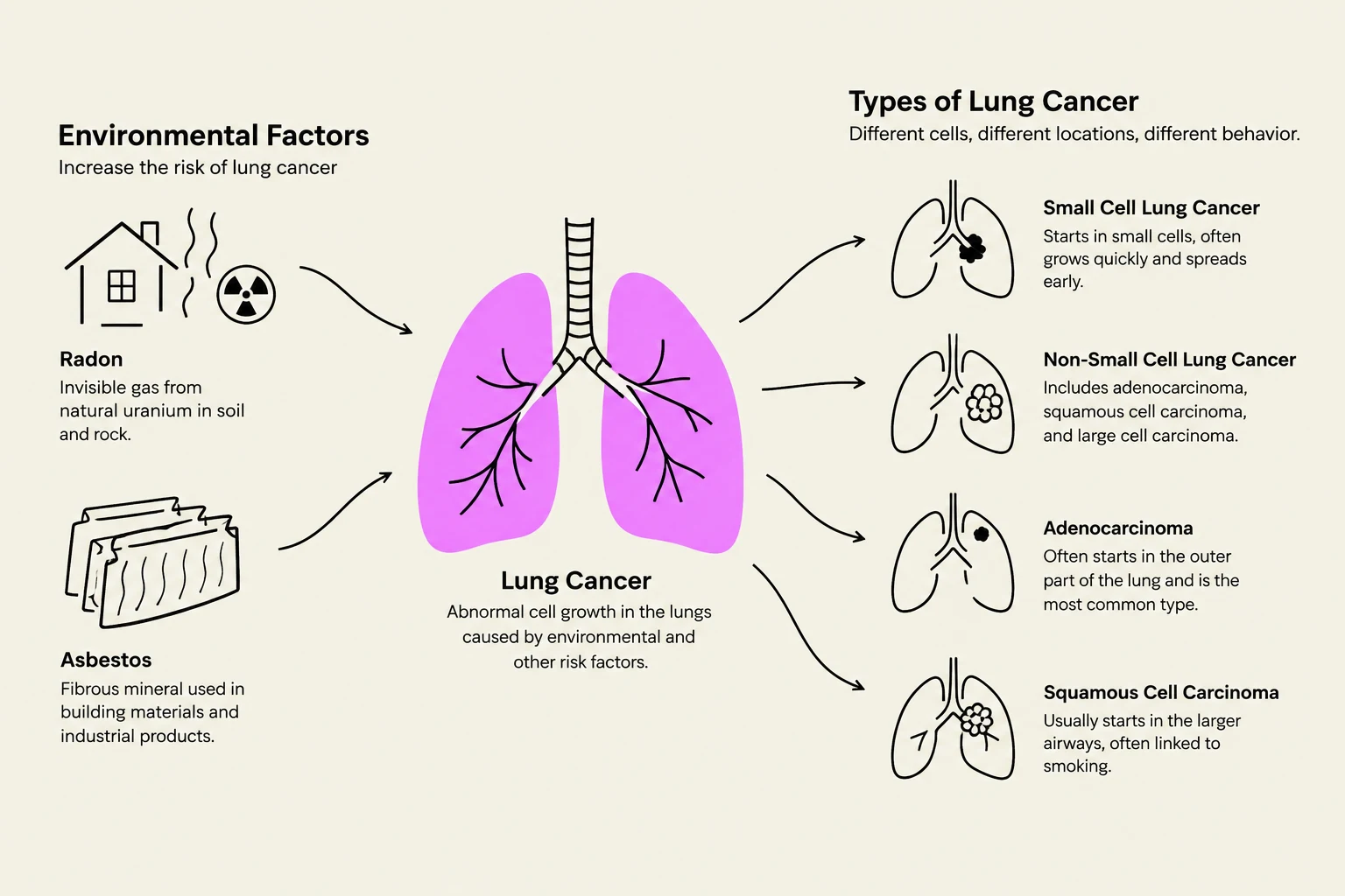This illustration details environmental factors contributing to lung cancer, such as radon and asbestos, and categorizes different types of lung cancer including small cell, non-small cell (adenocarcinoma, squamous cell carcinoma), and their characteristics.