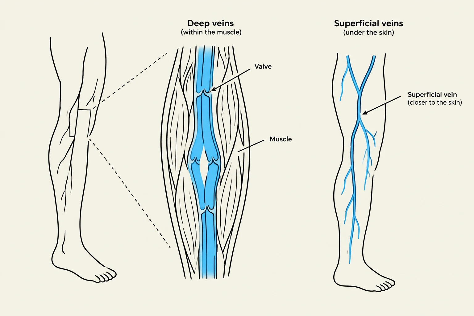 Diagram illustrating the difference between deep veins within the muscle and superficial veins under the skin, highlighting the presence of valves in deep veins.