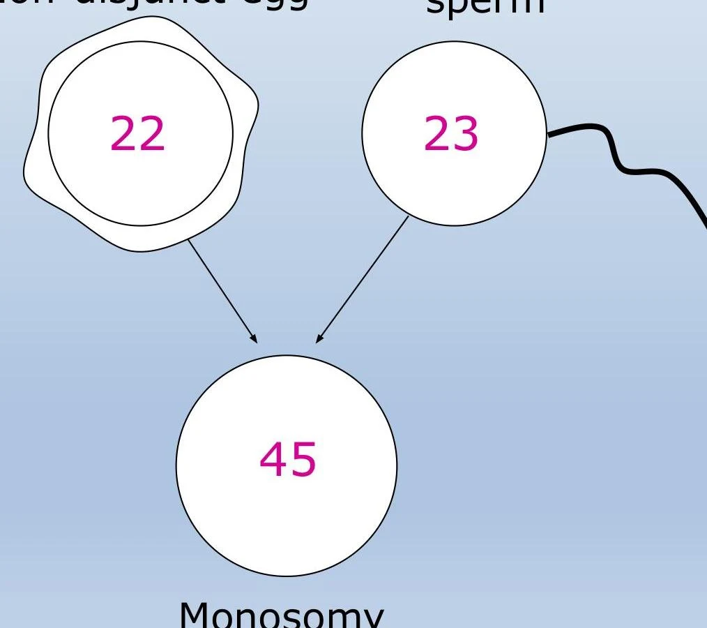 Diagram illustrating monosomy, where an egg with 22 chromosomes fuses with a sperm with 23 chromosomes, resulting in a total of 45 chromosomes.