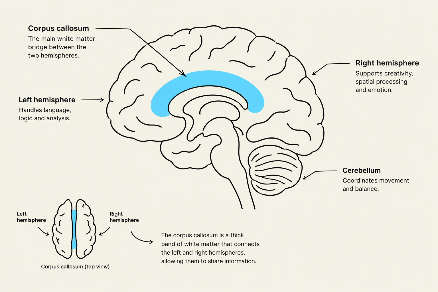 This illustration shows a sagittal view of the human brain, highlighting the corpus callosum, left and right hemispheres, and cerebellum, along with a top view of the corpus callosum.
