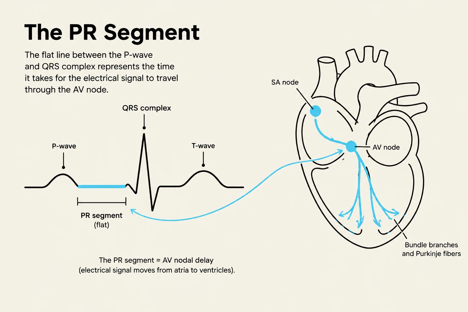 This diagram illustrates the PR segment of an electrocardiogram (ECG), which represents the time it takes for the electrical signal to travel from the SA node, through the AV node, and into the ventricles via the bundle branches and Purkinje fibers.